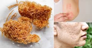 Dried Sea Moss: Nature’s Source of nourishment-Wealthy Superfood post thumbnail image