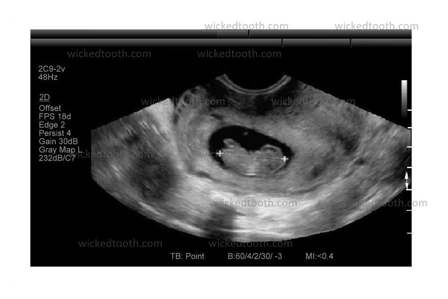 What positive aspects can an fake transporting a young child ultrasound evaluation be got nowadays? post thumbnail image