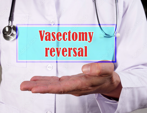 Understanding Vasectomy Reversal Cost: What to Expect post thumbnail image